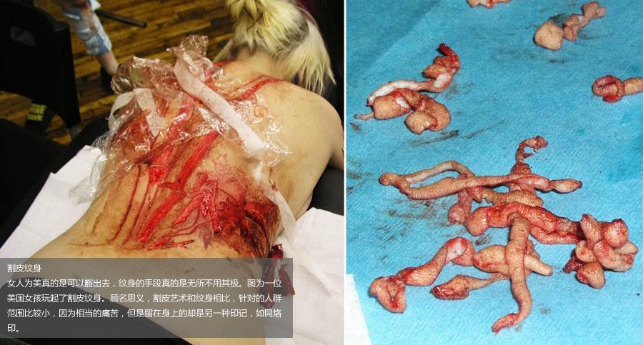 美丽的代价 全球<em>误入歧途的</em>美妆达人5081423