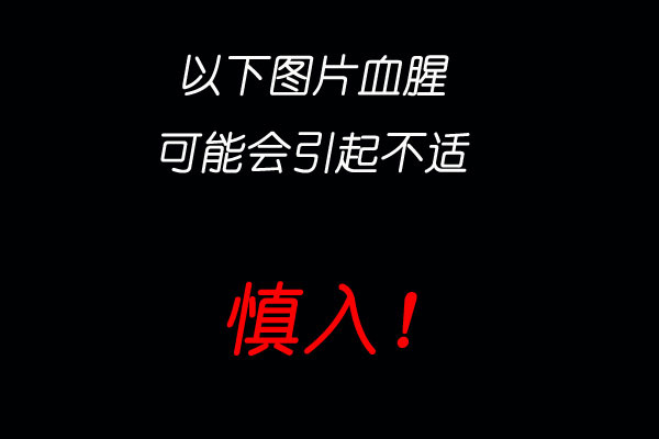 NBA惊现<em>行尸走肉</em> 猛龙前锋扮丧尸胆小勿入(图