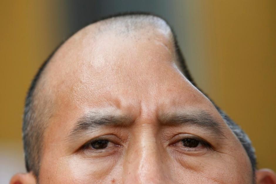 男子打瘪半个脑袋图片