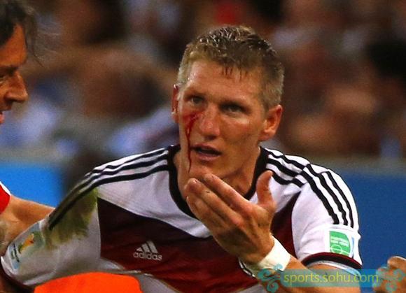 高清图:小猪惨吃阿奎罗铁掌 面部飙血下场缝针